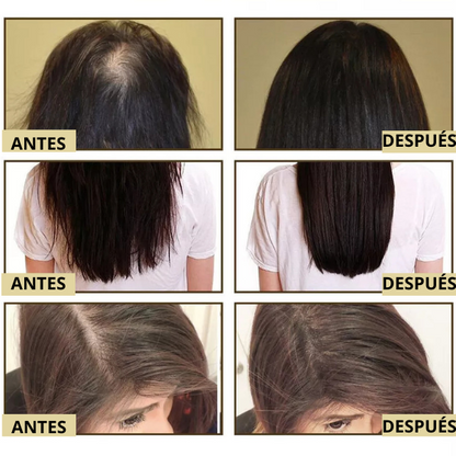 Aceite Natural Vegano Para Crecimiento del Cabello